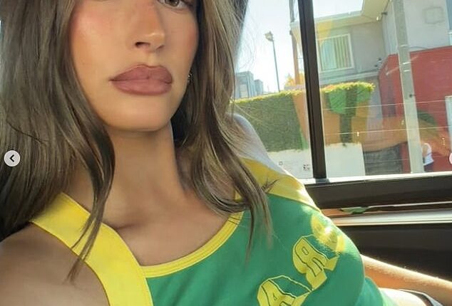 Hailey Bieber candidly opened up about what cosmetic procedures she's had performed on her face