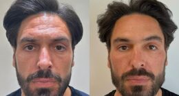 Mario Falcone is determined to keep his title as the hottest dad at the school gates (pictured L before his treatments and R four weeks after his treatments in July)