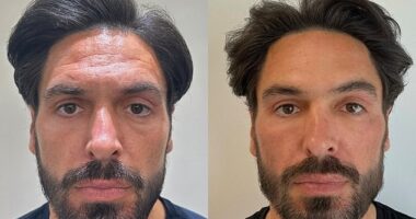 Mario Falcone is determined to keep his title as the hottest dad at the school gates (pictured L before his treatments and R four weeks after his treatments in July)