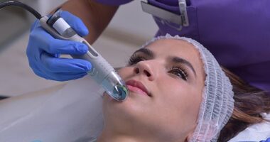 Chin hairs are more common in peri-menopausal and menopausal women because the levels of oestrogen fall over time, meaning androgens become relatively more dominant