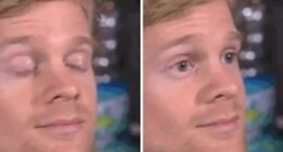 Man Behind “Blinking Guy” GIF Is Unrecognizable 8 Years After Becoming Internet Star