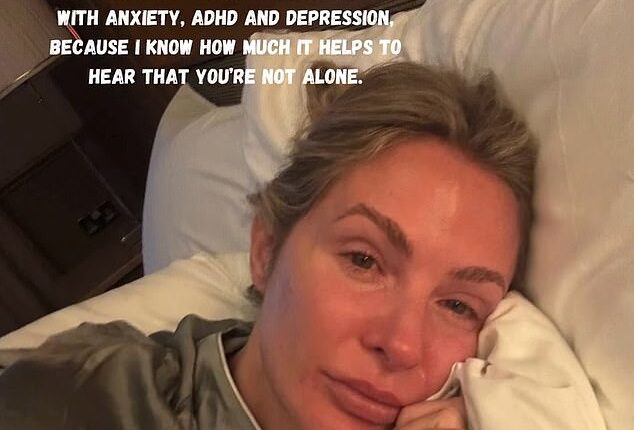 Millie Mackintosh has taken to Instagram to share a teary-eyed selfie as she detailed her mental health struggles, after her ex-husband Professor Green revealed they're back in touch