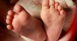 Mom Steamed Infant Daughter’s Face Until Her Skin Peeled Off Because She Wasn’t a Boy