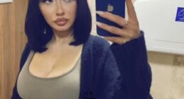 Chloe Richmond, 25, lost her mother and father at a young age - and began suffering headaches soon after