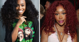 SZA’s “Before And After” Confessions And The Aftermath Of Cosmetic Transformation
