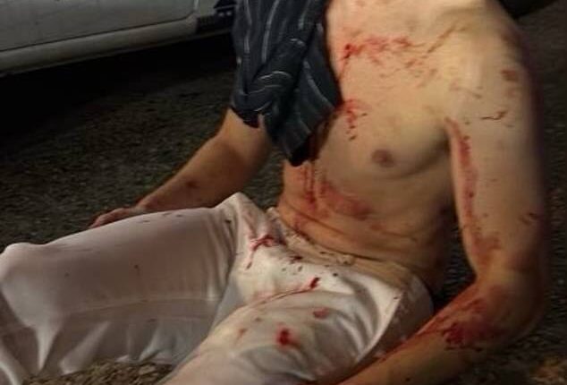 Edward Coristine, 19, was attacked by a gang of youths during an attempted carjacking on the crime-ravaged streets of Washington DC at 3am on August 3