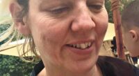 Dr Justine Hextall pictured before she made 11 lifestyle changes that had a dramatic impact on her skin