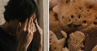 Trypophobia Explained: Why Your Brain Reacts To Tiny Holes