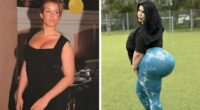 15 Women Who Had A BBL And Faced Tragic Consequences In Their Quest For Perfect Curves