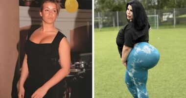 15 Women Who Had A BBL And Faced Tragic Consequences In Their Quest For Perfect Curves