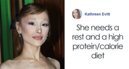 Ariana Grande Stuns Fans By Revealing Diagnosis Amid ‘Wicked’ Press Tour