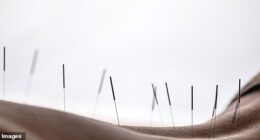 I met the man who can fix your body odour, fertility issues and even get you a girlfriend. He's the master acupuncturist beloved by the A-list... and these are his secrets