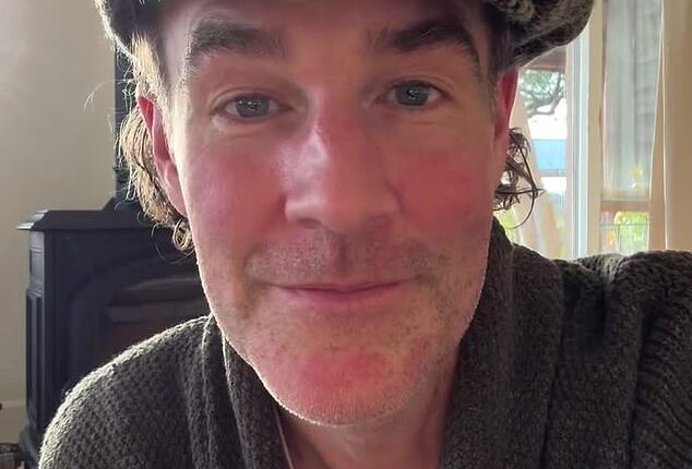 James Van Der Beek, 48, is putting a number of his cherished Dawson's Creek keepsakes on auction to help pay for his 'expensive' cancer treatments