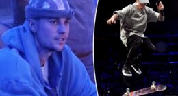 Justin Bieber suffers fall from electric skateboard