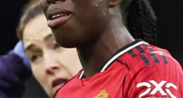 Man United's Simi Awujo sports a head bump