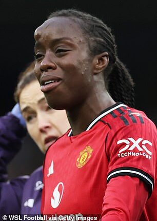 Man United's Simi Awujo sports a head bump