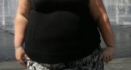 Claire Kane (pictured before her weight loss), from Airdrie, Scotland, dreamed of starting a family, but her 29st 5lb frame affected her health and limited her fertility options