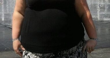 Claire Kane (pictured before her weight loss), from Airdrie, Scotland, dreamed of starting a family, but her 29st 5lb frame affected her health and limited her fertility options