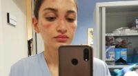 Nurse Treating Coronavirus Patients In Italy Shares How Hard It Is With A Heartbreaking Pic