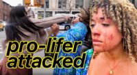 “Pure Evil”: Pro-Life Activist Left Bloody After Vile Attack During Abortion Street Interview