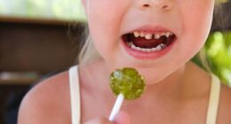 Quarter of five-year-olds in England have tooth decay, damning report finds