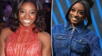 Simone Biles reveals plastic surgery procedures she’s had done