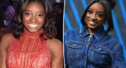 Simone Biles reveals plastic surgery procedures she’s had done