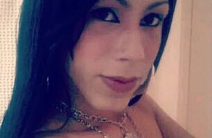 Brazilian influencer Juliana Oliveira, known as Juju do Pix, is going under the knife after she claims that she was left disfigured after cosmetic injections gone wrong (seen before)