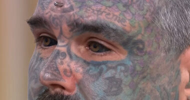 “Total Stupidity!”: Man Who Got His Eyeballs Tattooed Reveals Dangerous Process