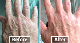 We’re Not Blushing Anymore: 18 Fixes For Those Embarrassing Body Probs