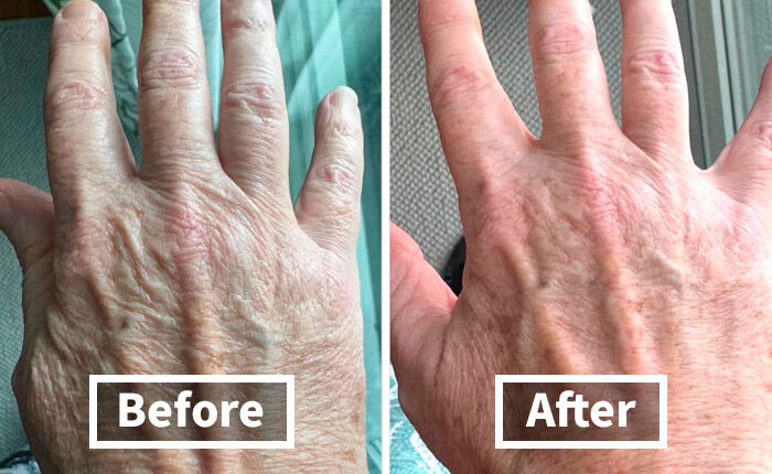 We’re Not Blushing Anymore: 18 Fixes For Those Embarrassing Body Probs