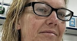 LeAnn Hawks, from Arizona, pictured before her facelift