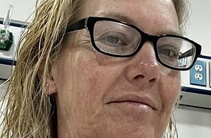 LeAnn Hawks, from Arizona, pictured before her facelift