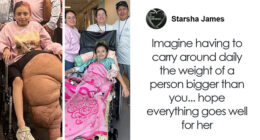 14YO Girl With Rare Condition Undergoes 17 Hours Of Grueling Surgery To Remove 174lb Leg