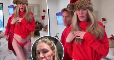 Brandi Glanville rocks red bikini bottoms in holiday video after receiving diagnosis for face disfigurement