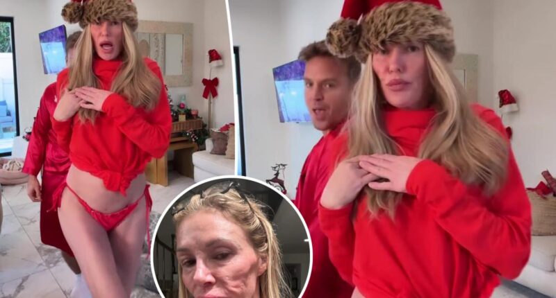 Brandi Glanville rocks red bikini bottoms in holiday video after receiving diagnosis for face disfigurement