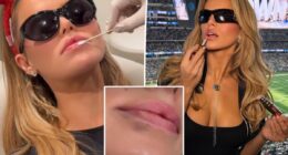 Brooks Nader dissolves lip filler as Christmas gift to parents after Disneyland visit