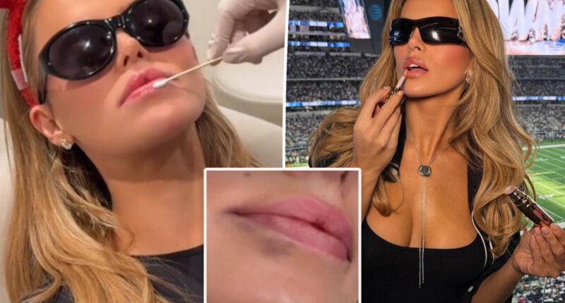 Brooks Nader dissolves lip filler as Christmas gift to parents after Disneyland visit