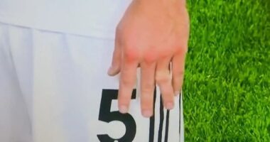 Joachim Andersen appeared to dislocate a finger during Fulham's tie with Nottingham Forest
