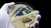 Fungus that causes deadly infections found in over 60 countries globally