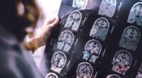 British researchers say a cure for Alzheimer'sdisease could one day be possible, with experts suggesting truly life-changing treatments may emerge within the next five to ten years