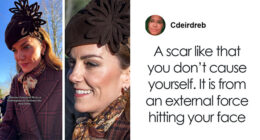 “Never Had Cancer”: Video Of Kate Middleton’s “Scar” During Christmas Appearance Sparks Wild Conspiracy Theories