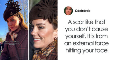 “Never Had Cancer”: Video Of Kate Middleton’s “Scar” During Christmas Appearance Sparks Wild Conspiracy Theories