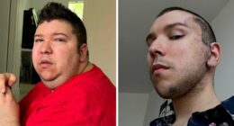 Nikocado Avocado Undergoes Cosmetic Surgery, Shares Results