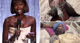 Supermodel Anok Yai, 28, diagnosed with congenital defect that's 'destroying' her lungs
