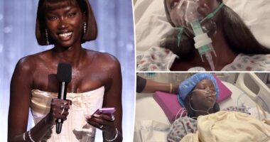 Supermodel Anok Yai, 28, diagnosed with congenital defect that's 'destroying' her lungs