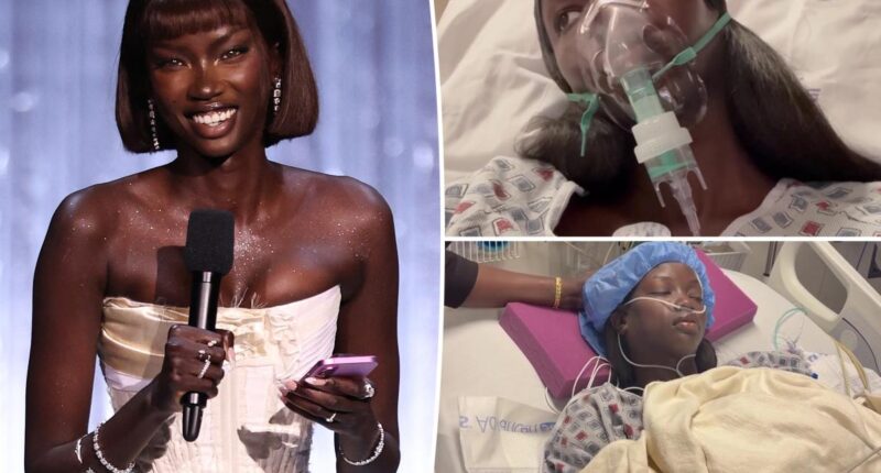 Supermodel Anok Yai, 28, diagnosed with congenital defect that's 'destroying' her lungs
