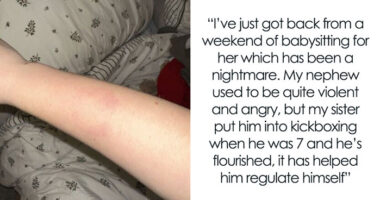Woman Gets Bitten By Autistic Nephew, Refuses To Babysit After Sis Says She Won’t Discipline Him