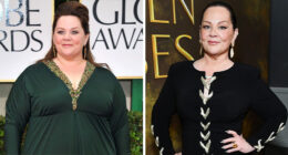 10 Stars Whose Dramatic Transformations Stunned Fans At The 2026 Golden Globes