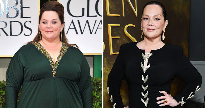 10 Stars Whose Dramatic Transformations Stunned Fans At The 2026 Golden Globes